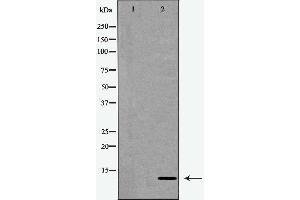 Western blot analysis of extracts from Jurkat cells, treated with serum (20%, 15mins), using CKS1 antibody.
