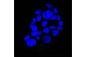 Immunofluorescence (IF) image for anti-Epidermal Growth Factor Receptor (EGFR) (Extracellular Domain) antibody (ABIN6939288)