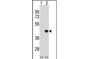 Western blot analysis of DA2 (arrow) using mouse polyclonal DA2 Antibody (ABIN1539794 and ABIN2843771).