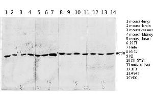 anti-Actin (AA 300-380) antibody