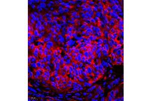 DPYSL4 antibody