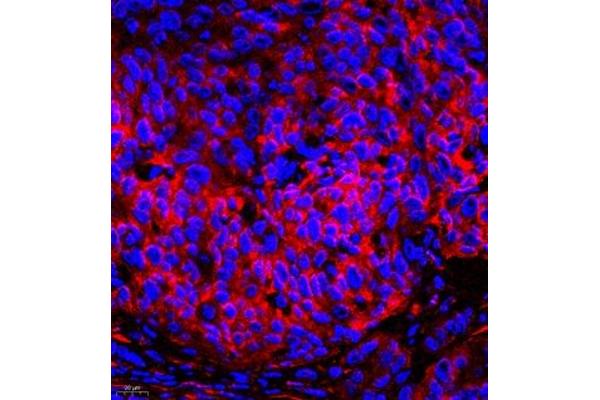 DPYSL4 antibody