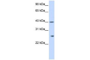WB Suggested Anti-GSTK1 Antibody Titration: 0. (GSTK1 antibody  (N-Term))