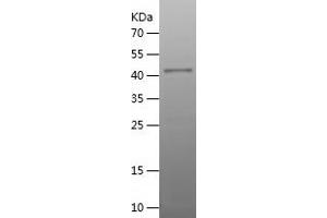 Western Blotting (WB) image for Lysosomal-Associated Membrane Protein 2 (LAMP2) (AA 34-231) protein (His-IF2DI Tag) (ABIN7283498) (LAMP2 Protein (AA 34-231) (His-IF2DI Tag))