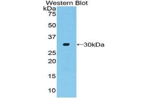 Western blot analysis of the recombinant protein. (ADCY2 antibody  (AA 294-525))