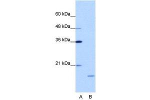 WB Suggested Anti-ISG20  Antibody Titration: 1.