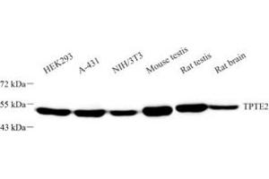 Western blot analysis of TPTE2 (ABIN7075990) at dilution of 1: 1000 (TPTE2 antibody)