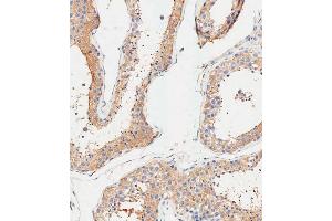 Immunohistochemical analysis of paraffin-embedded Human testis tissue using (ABIN1945086 and ABIN2838551) performed on the Leica® BOND RXm. (ALDH1A1 antibody  (AA 306-339))