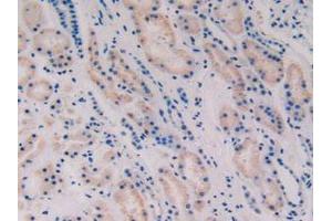 IHC-P analysis of Human Kidney Tissue, with DAB staining. (Vip antibody  (AA 29-165))