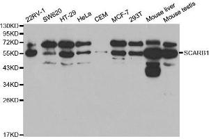 Western blot analysis of extracts of various cell lines, using SCARB1 antibody. (SCARB1 antibody  (AA 1-100))