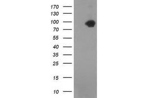 HEK293T cells were transfected with the pCMV6-ENTRY control (Left lane) or pCMV6-ENTRY CTNNB1 (Right lane) cDNA for 48 hrs and lysed. (CTNNB1 antibody)