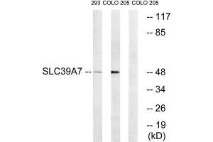 Western Blotting (WB) image for anti-Solute Carrier Family 39 (Zinc Transporter), Member 7 (SLC39A7) (Internal Region) antibody (ABIN1852426)