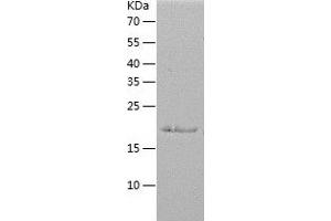 Western Blotting (WB) image for Dynactin 5 (p25) (DCTN5) (AA 1-182) protein (His tag) (ABIN7122717) (DCTN5 Protein (AA 1-182) (His tag))