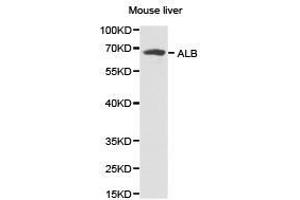 Western Blotting (WB) image for anti-Albumin (ALB) antibody (ABIN1870915) (Albumin antibody)
