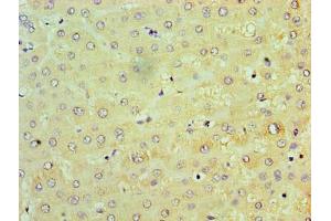 Immunohistochemistry of paraffin-embedded human liver tissue using ABIN7172247 at dilution of 1:100 (TRAF6 antibody  (AA 1-522))