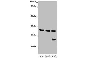 Western blot All lanes: SLC25A10 antibody at 16 μg/mL Lane 1: Mouse liver tissue Lane 2: Mouse kidney tissue Lane 3: HepG2 whole cell lysate Secondary Goat polyclonal to rabbit IgG at 1/10000 dilution Predicted band size: 32, 33 kDa Observed band size: 32, 24 kDa