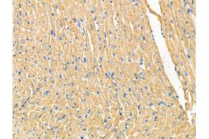 ABIN6265176 and ABIN6268795 at 1/100 staining Rat heart tissue by IHC-P.