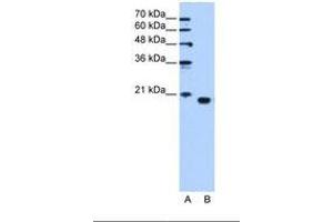 Image no. 1 for anti-Phosphatidylethanolamine Binding Protein 1 (PEBP1) (C-Term) antibody (ABIN321403) (PEBP1 antibody  (C-Term))