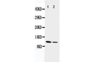 Anti-Resistin antibody, Western blotting Lane 1: Recombinant Mouse Resistin Protein 10ng Lane 2: Recombinant Mouse Resistin Protein 5ng (Resistin antibody  (C-Term))