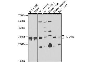 Western blot analysis of extracts of various cell lines, using SPIN2B antibody  at 1:1000 dilution. (Spindlin 2B antibody  (AA 1-258))