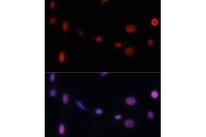 Immunofluorescence (IF) image for anti-Cyclin-Dependent Kinase Inhibitor 1A (p21, Cip1) (CDKN1A) (AA 43-142) antibody (ABIN3022006)