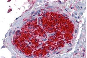 Human Peripheral Nerve: Formalin-Fixed, Paraffin-Embedded (FFPE) (SGCB antibody  (AA 87-197))