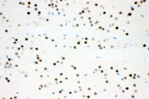 IHC analysis of Ataxin 1 using anti-Ataxin 1 antibody (ABIN3043506). (Ataxin 1 antibody  (C-Term))