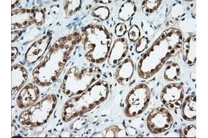 Immunohistochemical staining of paraffin-embedded Human thyroid tissue using anti-BDH2 mouse monoclonal antibody.