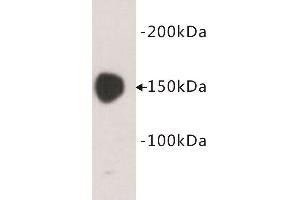 Western Blotting (WB) image for anti-Carcinoembryonic Antigen Gene Family (CEA) antibody (ABIN1854846) (CEA antibody)