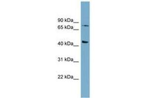 Image no. 1 for anti-Frizzled Family Receptor 6 (FZD6) (AA 539-588) antibody (ABIN6743054) (FZD6 antibody  (AA 539-588))
