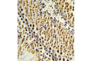 Formalin fixed and paraffin embedded testis tissue reacted with EXTL3 Antibody (N-term) followed by peroxidase conjugation of the secondary antibody and DAB staining. (EXTL3 antibody  (N-Term))