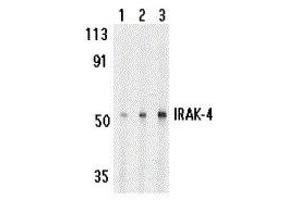 Western Blotting (WB) image for anti-Interleukin-1 Receptor-Associated Kinase 4 (IRAK4) (C-Term) antibody (ABIN2475135) (IRAK4 antibody  (C-Term))