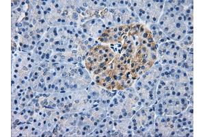 Immunohistochemical staining of paraffin-embedded liver tissue using anti-AKR1A1mouse monoclonal antibody. (AKR1A1 antibody)