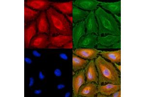 ABIN6262285 and ABIN6279484 staining  cells(UV treatment) by IF/ICC.