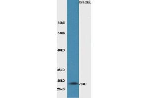 Lane 1: Mouse lung lysate probed with Rabbit Anti-BAK Polyclonal Antibody, Unconjugated  at 1:5000 for 90 min at 37˚C. (BAK1 antibody  (AA 21-120))