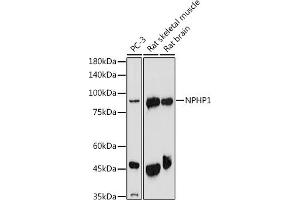 Western blot analysis of extracts of various cell lines, using NPHP1 antibody (ABIN6128349, ABIN6144768, ABIN6144769 and ABIN6222377) at 1:1000 dilution.