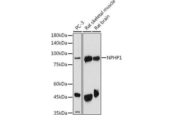 NPHP1 抗体  (AA 345-614)