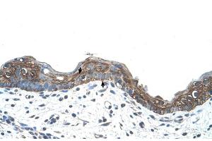 Human Skin (Erythrocyte Ankyrin antibody  (C-Term))