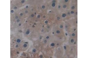 IHC-P analysis of Human Tissue, with DAB staining. (SPP2 antibody  (AA 30-211))