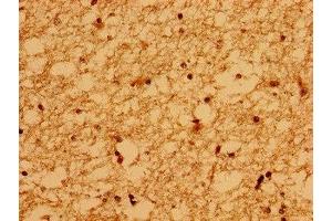 Immunohistochemistry of paraffin-embedded human brain tissue using ABIN7175718 at dilution of 1:100