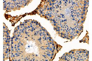ABIN6259349 and ABIN6275564 at 1/100 staining Mouse testis tissue by IHC-P. (STAC2 antibody  (Internal Region))