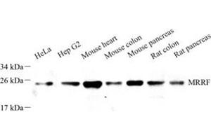 Western blot analysis of MRRF (ABIN7074657) at dilution of 1: 1000