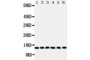 Anti-Glutaredoxin 2 antibody, Western blotting Lane 1: Rat Testis Tissue Lysate Lane 2: HELA Cell Lysate Lane 3: U87 Cell Lysate Lane 4: NEU Cell Lysate Lane 5: JURKAT Cell Lysate Lane 6: MCF-7 Cell Lysate (Glutaredoxin 2 antibody  (Middle Region))