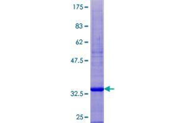 SPINK14 Protein (AA 1-97) (GST tag)