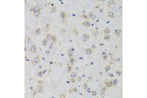 Immunohistochemistry (Paraffin-embedded Sections) (IHC (p)) image for anti-ISG15 Ubiquitin-Like Modifier (ISG15) (AA 1-165) antibody (ABIN3021653)