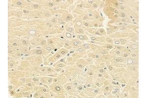 anti-Potassium Inwardly-Rectifying Channel, Subfamily J, Member 13 (KCNJ13) (Internal Region) antibody