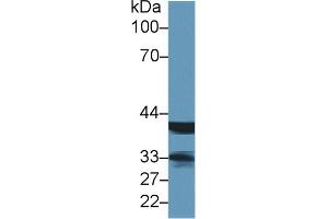Western Blot; Sample: Rat Lymph node lysate; Primary Ab: 1µg/ml Rabbit Anti-Human LMAN2 Antibody Second Ab: 0. (LMAN2 antibody  (AA 45-322))