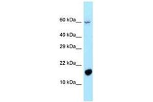 Image no. 1 for anti-Chromosome 5 Open Reading Frame 13 (C5orf13) (AA 13-62) antibody (ABIN6747935) (NREP antibody  (AA 13-62))