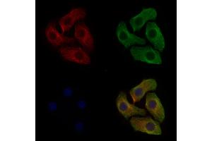 ABIN6255780 and ABIN6267335 staining Hela cells(4h of LPS treatment) by IF/ICC.
