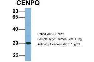 Host: Rabbit  Target Name: CENPQ  Sample Tissue: Human Fetal Lung  Antibody Dilution: 1. (CENPQ antibody  (N-Term))